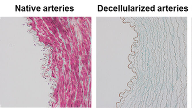 Caracterización de una arteria carótida porcina antes y después de la eliminación celular (descelularización), y tras su recelularización una vez tratadas con el polímero 8g7.