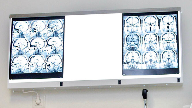 Imagen de archivo de una consulta de Neurología.
