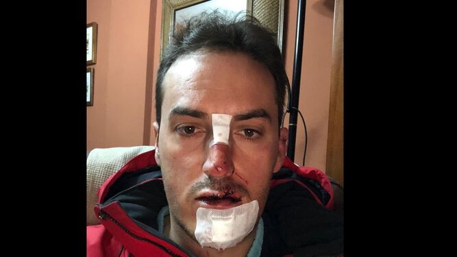 Alberto Ruiz el ciclista atropellado el 16 de enero en Gójar.