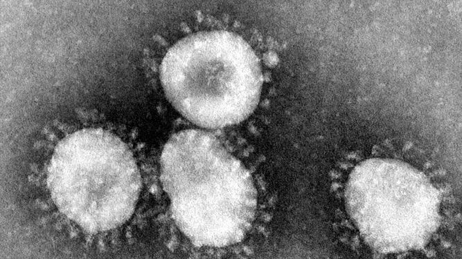 Imagen de coronavirus (original de Kapikian, 1969).
