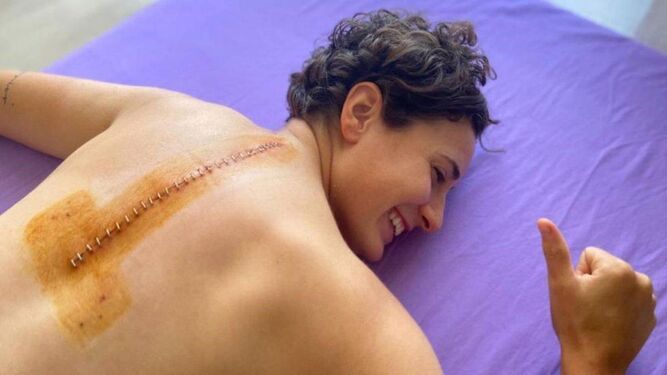 Ana Carrasco mostrando en sus redes la cicatriz de la operación