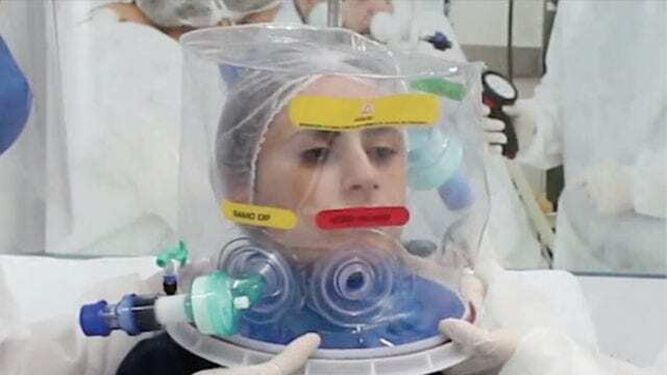 Científicos de Brasil crean cascos de respiración artificial para reducir hasta un 60% la intubación de los pacientes Covid