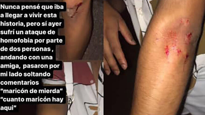 Un joven denuncia una agresión homófoba en Castell de Ferro (Granada)