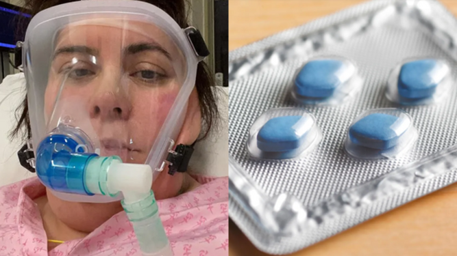 Un tratamiento con viagra salva la vida de una enfermera contagiada de coronavirus en Reino Unido