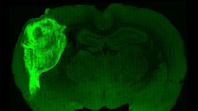 Un organoide humano trasplantado y marcado con una proteína fluorescente en una sección del cerebro de la rata.