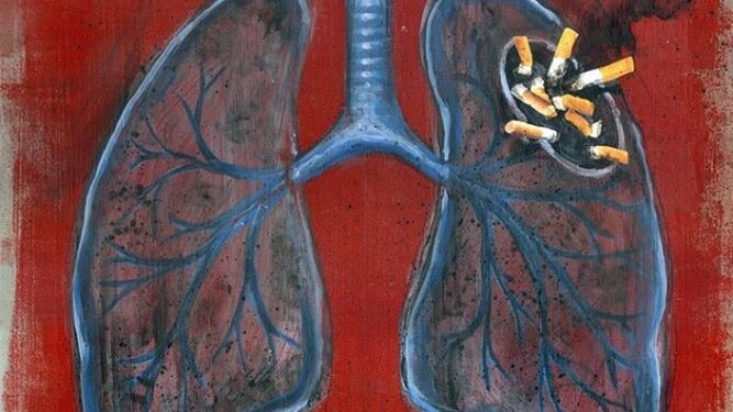 Lienzo que representa el tabaquismo como principal causa del cáncer de pulmón.