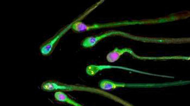 Espermatozoides vistos con un microscopio.