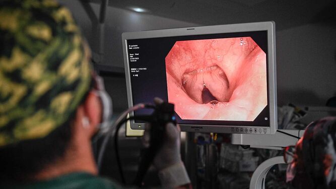El Hospital Virgen de las Nieves incorpora la endoscopia para tratar el enfisema pulmonar