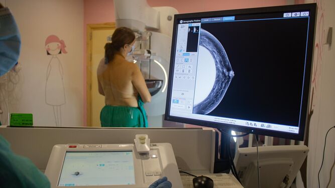 Imagen de archivo de una mamografía.