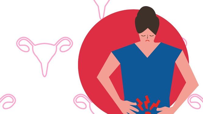 Endometriosis: síntomas y consecuencias de la enfermedad