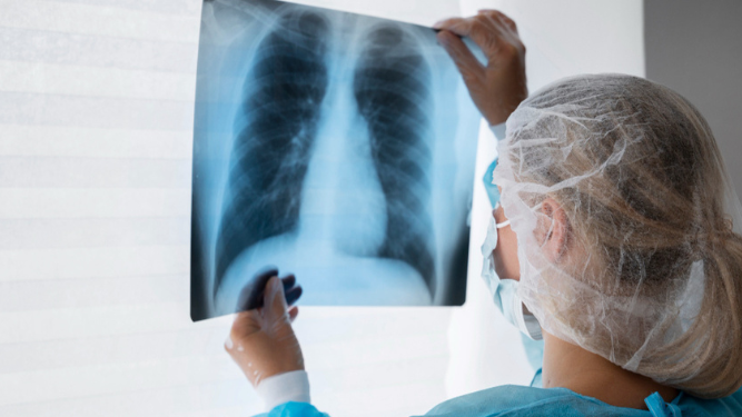 Médico revisando una radiografía de pulmón.